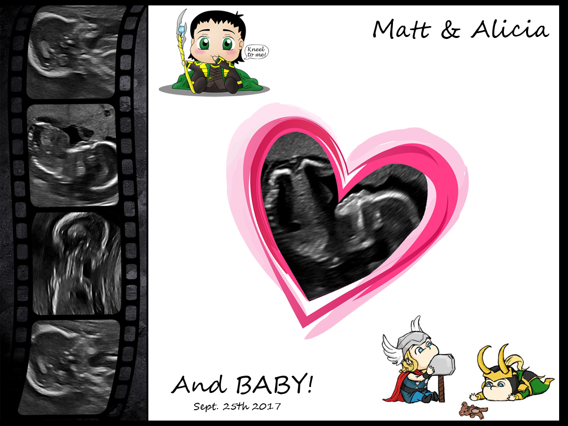 Baby 2017